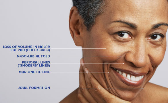 Key areas of ageing for females