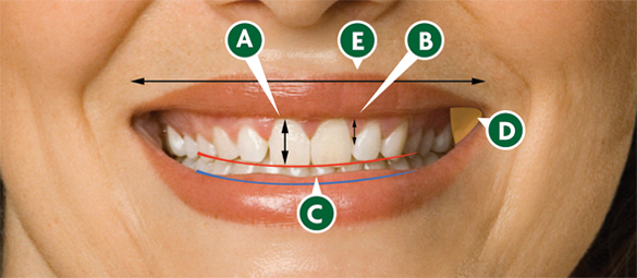 The Anatomy of the Smile